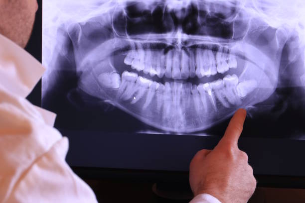Best Emergency TMJ Treatment in Gooding, ID